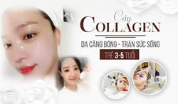 Cay-collagen-tuoi-bi-quyet-tre-hoa-lan-da-hieu-qua-tai-spa-Karuna