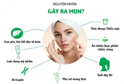 Nguyen-nhan-gay-mun-va-cach-dieu-tri-bang-cong-nghe-cao