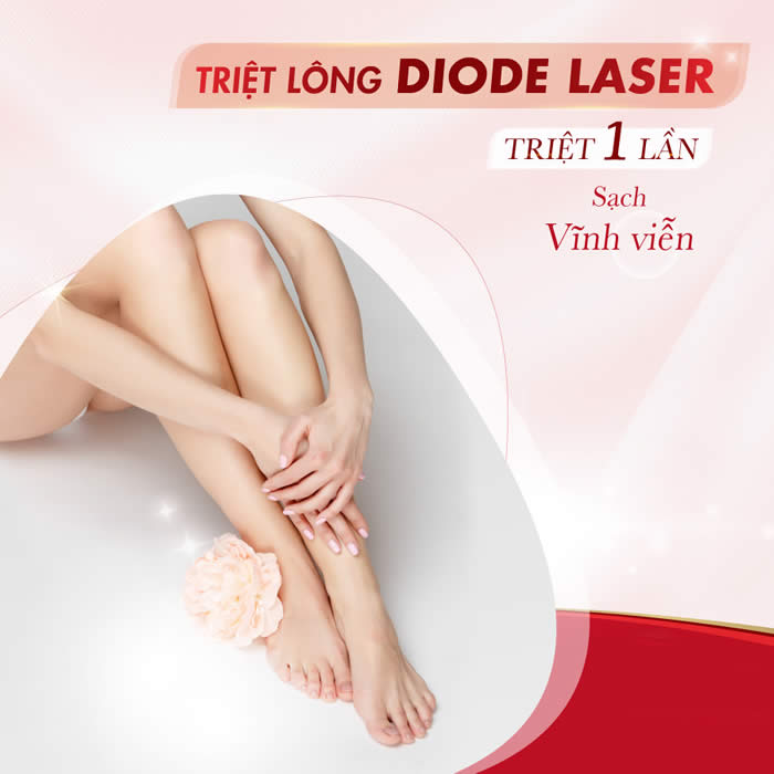 Triệt lông vĩnh viễn công nghệ Diode Laser