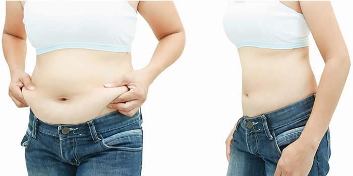 Thừa cân, béo phì khiến bạn mất tự tin, ảnh hưởng đến sức khỏe